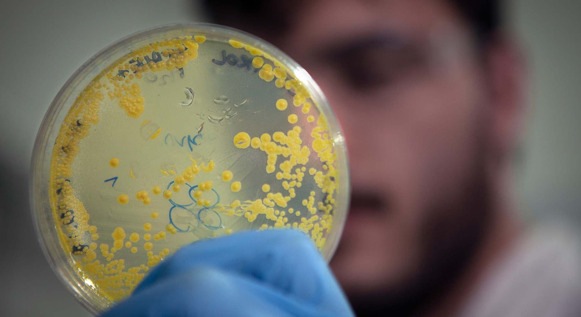 Photo of a person wearing surgical gloves and holding a petri dish containing yellow cells